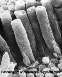 scanning EM of photoreceptor layer of retina